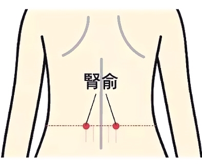 肾腧图片